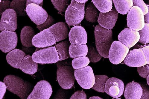 clostridium-perfringens.jpg